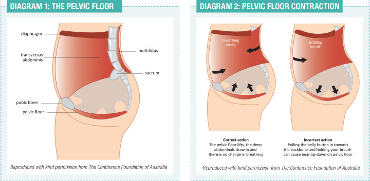 pulled pelvic floor muscle